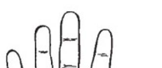 Второстепенные линии руки Линии под безымянным пальцем на левой руке